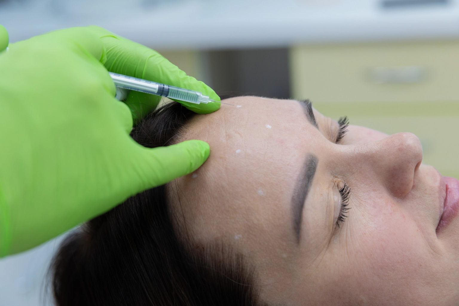 Close-up of a facial injection procedure.